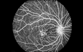 Retina Diagnostics